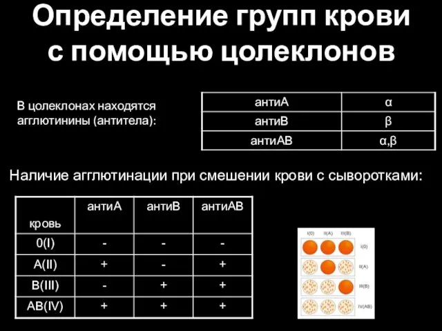 Определение групп крови с помощью цолеклонов В цолеклонах находятся агглютинины (антитела):