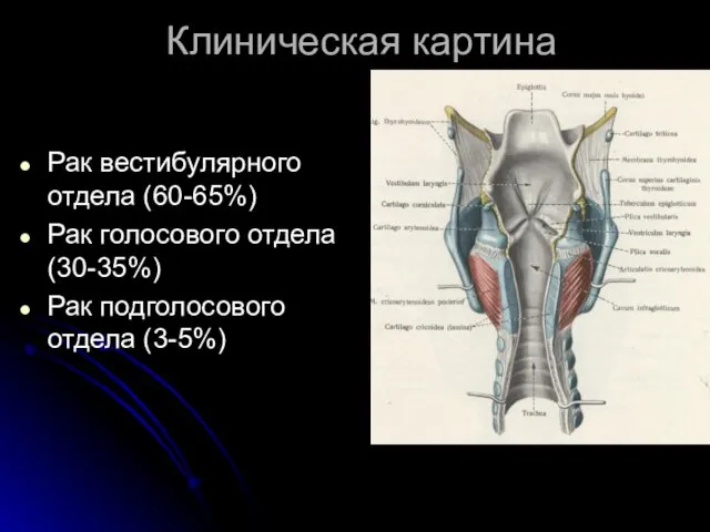 Клиническая картина Рак вестибулярного отдела (60-65%) Рак голосового отдела (30-35%) Рак подголосового отдела (3-5%)