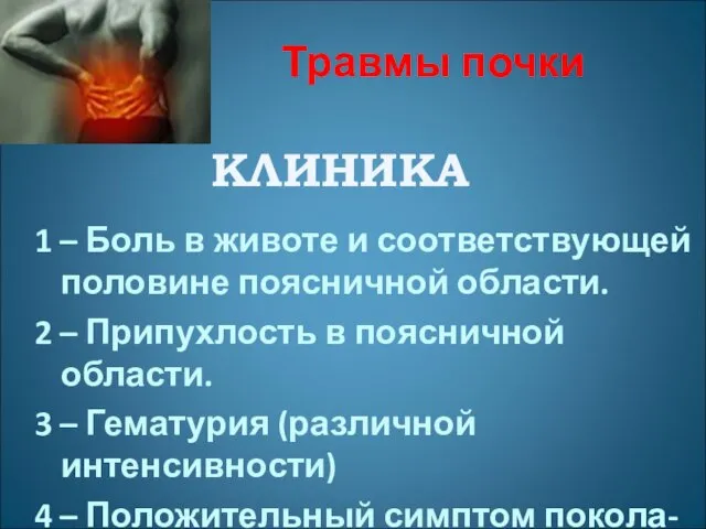 Травмы почки 1 – Боль в животе и соответствующей половине поясничной