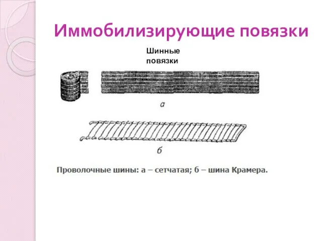 Иммобилизирующие повязки Шинные повязки