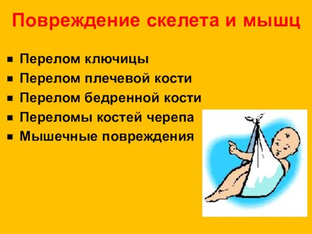 Повреждение скелета и мышц Перелом ключицы Перелом плечевой кости Перелом бедренной