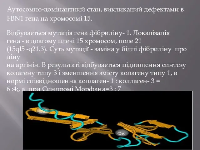 Аутосомно-домінантний стан, викликаний дефектами в FBN1 гена на хромосомі 15. Відбувається