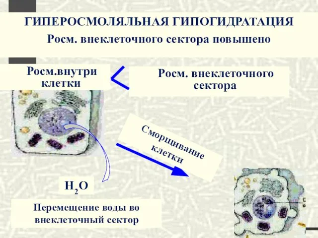 ГИПЕРОСМОЛЯЛЬНАЯ ГИПОГИДРАТАЦИЯ Росм. внеклеточного сектора повышено Росм.внутри клетки Н2О Росм. внеклеточного