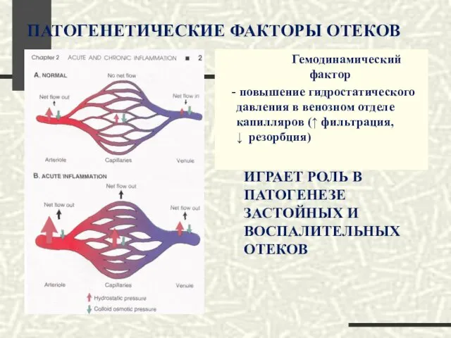 ПАТОГЕНЕТИЧЕСКИЕ ФАКТОРЫ ОТЕКОВ Гемодинамический фактор - повышение гидростатического давления в венозном