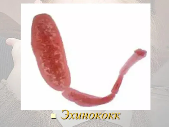 Эхинококк