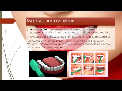 Методы чистки зубов Чистка зубов - гигиеническая процедура для очистки поверхности