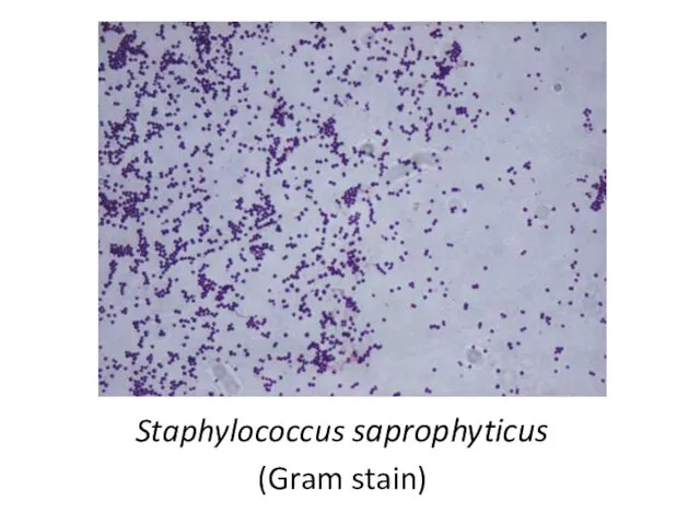 Staphylococcus saprophyticus (Gram stain)