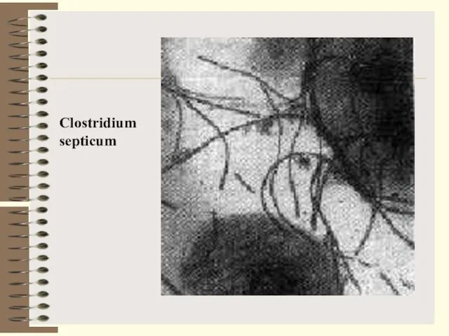 Clostridium septicum