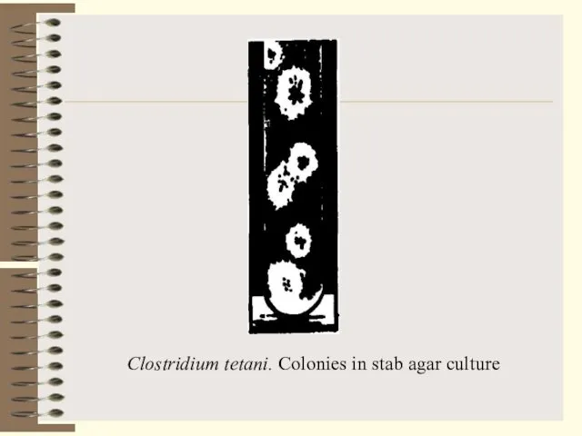 Clostridium tetani. Colonies in stab agar culture