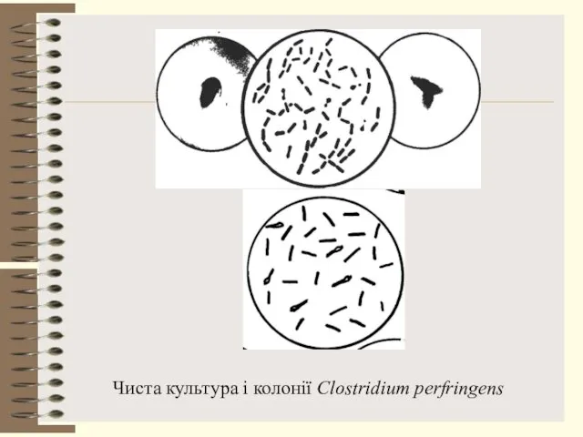 Чиста культура і колонії Clostridium perfringens