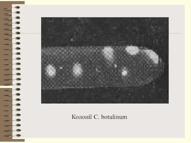 Колонії C. botulinum