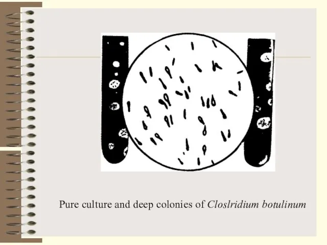 Pure culture and deep colonies of Closlridium botulinum