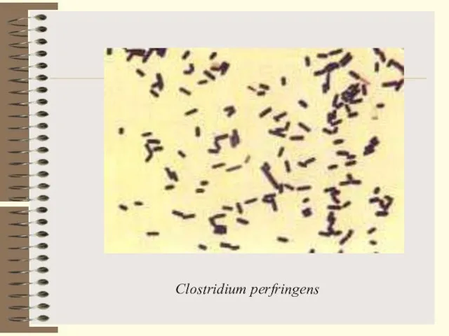 Clostridium perfringens