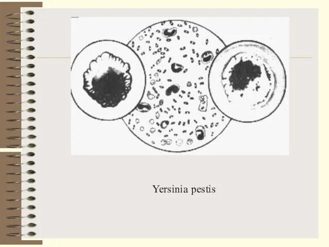 Yersinia pestis