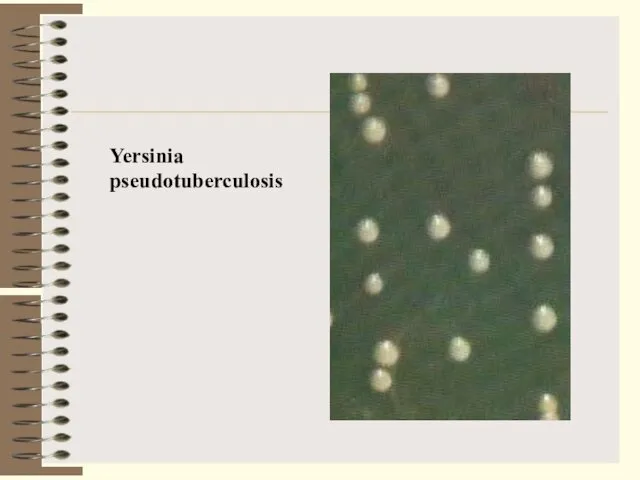 Yersinia pseudotuberculosis