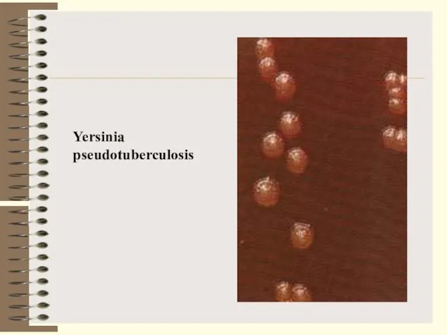 Yersinia pseudotuberculosis