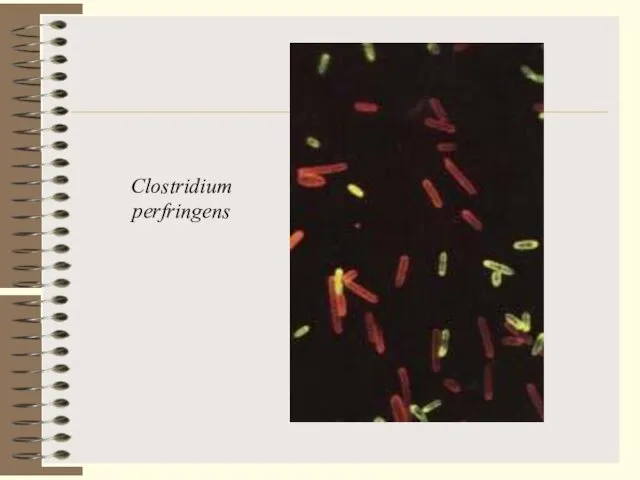 Clostridium perfringens