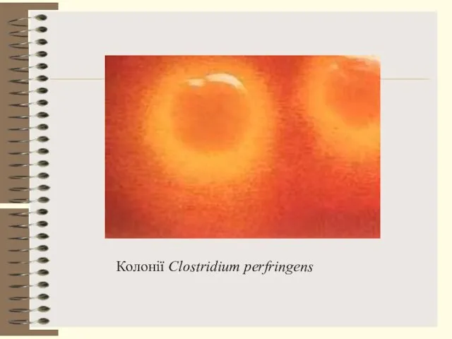 Колонії Clostridium perfringens