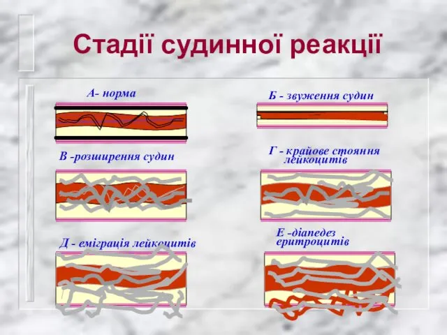 Стадії судинної реакції А- норма Б - звуження судин В -розширення