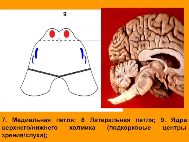 7. Медиальная петля; 8 Латеральная петля; 9. Ядра верхнего/нижнего холмика (подкорковые центры зрения/слуха); 9