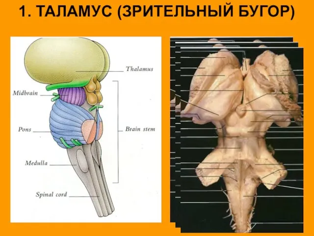 1. ТАЛАМУС (ЗРИТЕЛЬНЫЙ БУГОР)