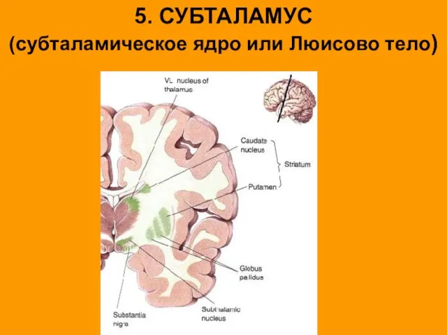 5. СУБТАЛАМУС (субталамическое ядро или Люисово тело)