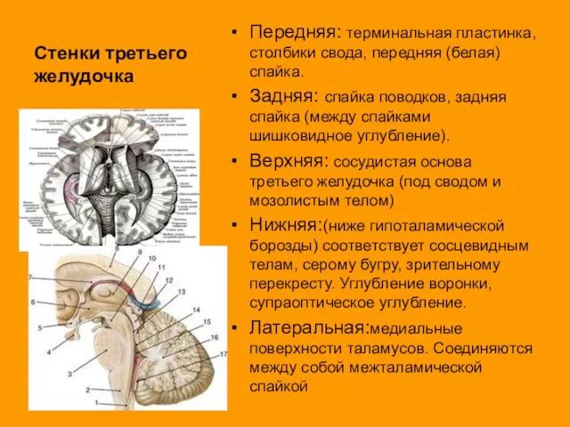 Стенки третьего желудочка Передняя: терминальная пластинка, столбики свода, передняя (белая) спайка.