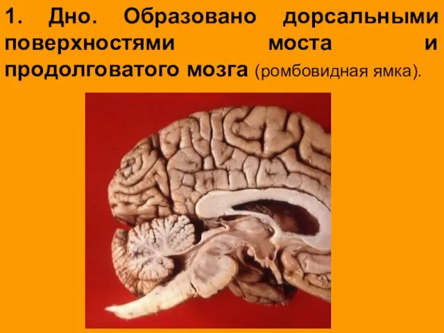 1. Дно. Образовано дорсальными поверхностями моста и продолговатого мозга (ромбовидная ямка).