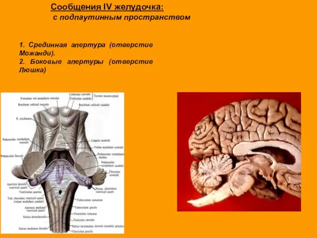 Сообщения IV желудочка: с подпаутинным пространством 1. Срединная апертура (отверстие Можанди). 2. Боковые апертуры (отверстие Люшка)