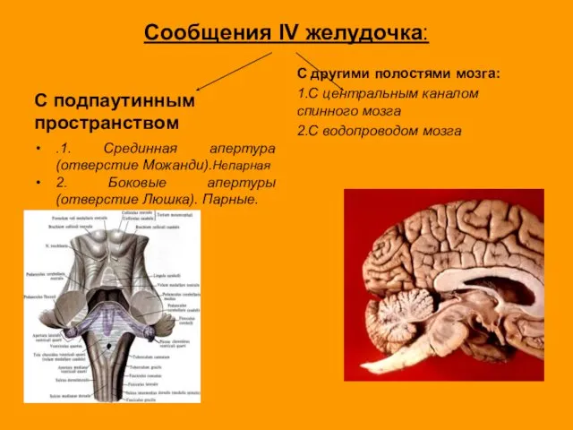 Сообщения IV желудочка: С подпаутинным пространством .1. Срединная апертура (отверстие Можанди).Непарная