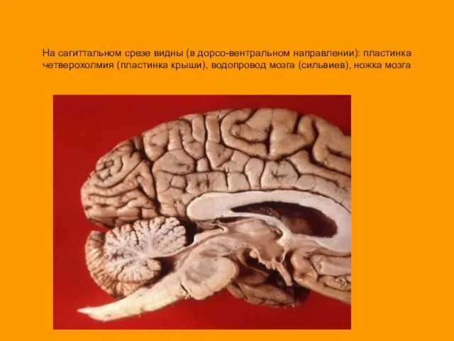 На сагиттальном срезе видны (в дорсо-вентральном направлении): пластинка четверохолмия (пластинка крыши), водопровод мозга (сильвиев), ножка мозга