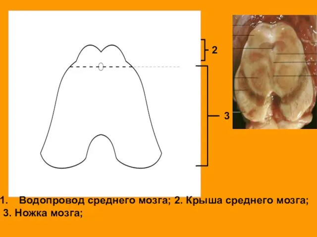 Водопровод среднего мозга; 2. Крыша среднего мозга; 3. Ножка мозга; 2 3