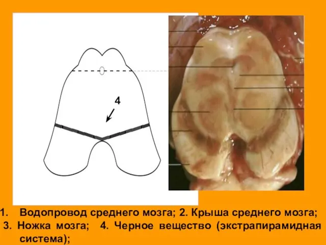 4 Водопровод среднего мозга; 2. Крыша среднего мозга; 3. Ножка мозга; 4. Черное вещество (экстрапирамидная система);