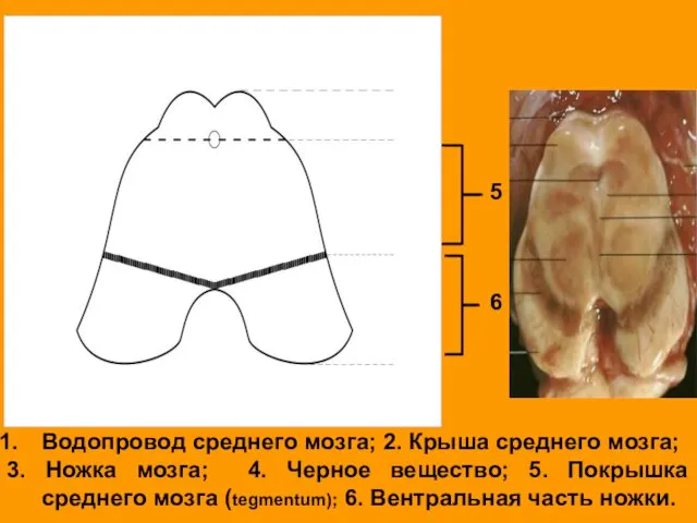 Водопровод среднего мозга; 2. Крыша среднего мозга; 3. Ножка мозга; 4.