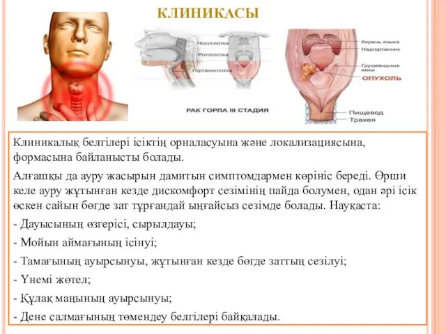 Клиникалық белгілері ісіктің орналасуына және локализациясына, формасына байланысты болады. Алғашқы да