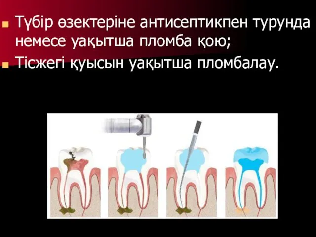 Түбір өзектеріне антисептикпен турунда немесе уақытша пломба қою; Тісжегі қуысын уақытша пломбалау.