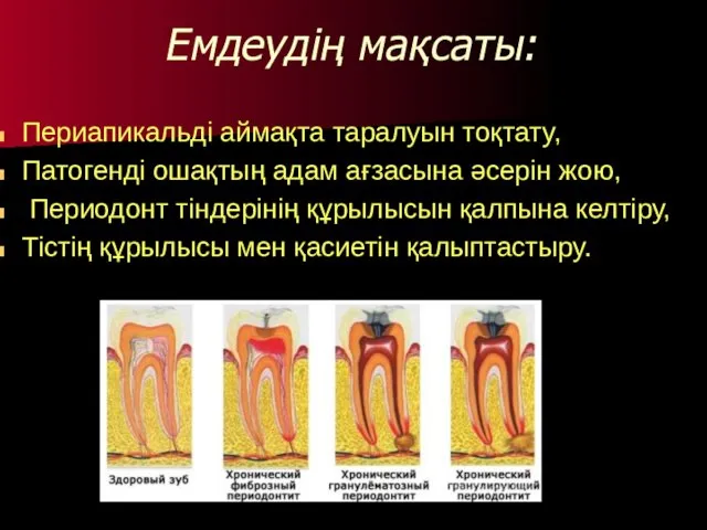 Емдеудің мақсаты: Периапикальді аймақта таралуын тоқтату, Патогенді ошақтың адам ағзасына әсерін