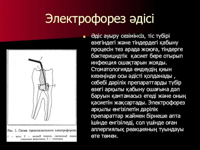 Электрофорез әдісі Әдіс ауыру сезімінсіз, тіс түбірі өзегіндегі және тіндердегі қабыну