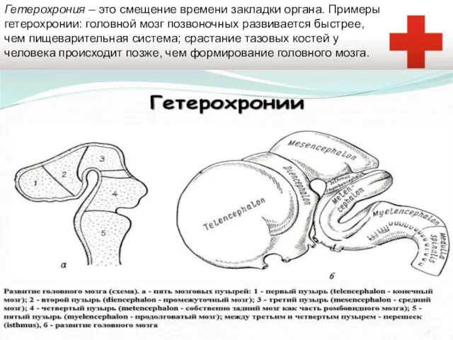 Гетерохрония – это смещение времени закладки органа. Примеры гетерохронии: головной мозг