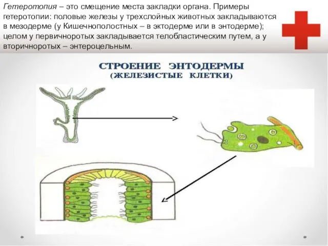 Гетеротопия – это смещение места закладки органа. Примеры гетеротопии: половые железы