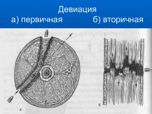 Девиация а) первичная б) вторичная