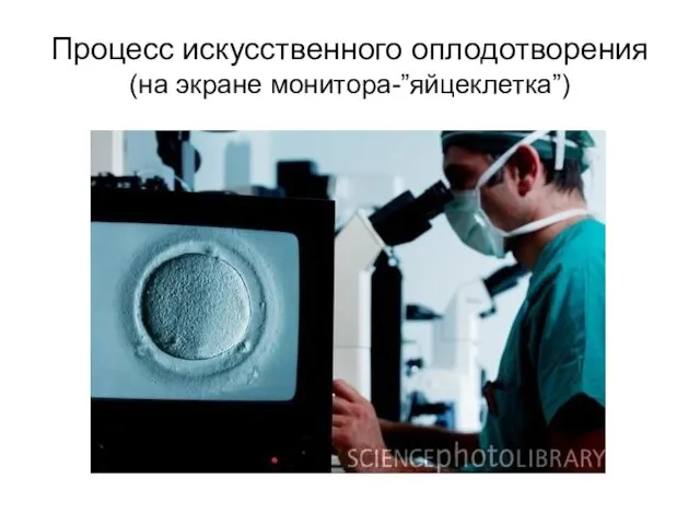 Процесс искусственного оплодотворения (на экране монитора-”яйцеклетка”)
