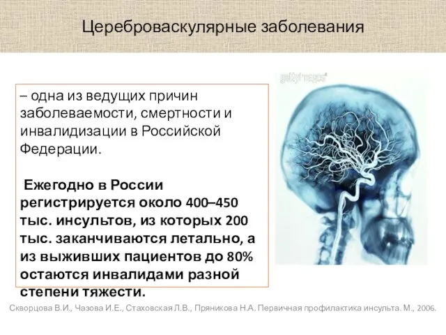 Цереброваскулярные заболевания Скворцова В.И., Чазова И.Е., Стаховская Л.В., Пряникова Н.А. Первичная