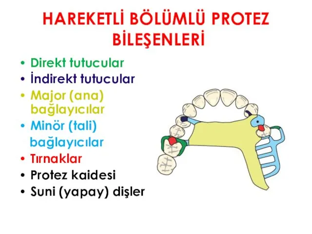 HAREKETLİ BÖLÜMLÜ PROTEZ BİLEŞENLERİ Direkt tutucular İndirekt tutucular Major (ana) bağlayıcılar