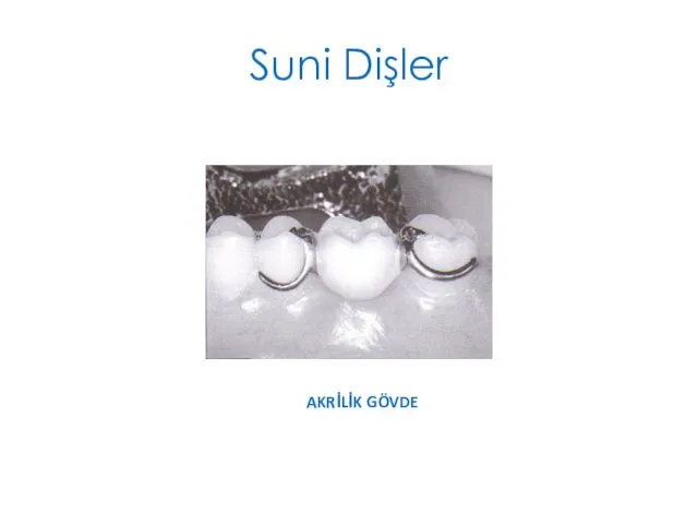 Suni Dişler AKRİLİK GÖVDE