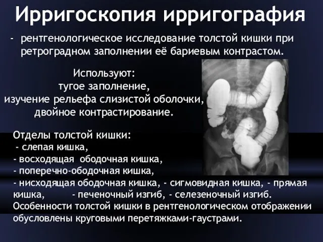 Ирригоскопия ирригография рентгенологическое исследование толстой кишки при ретроградном заполнении её бариевым