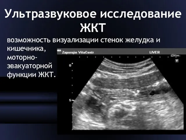 Ультразвуковое исследование ЖКТ возможность визуализации стенок желудка и кишечника, моторно- эвакуаторной функции ЖКТ.