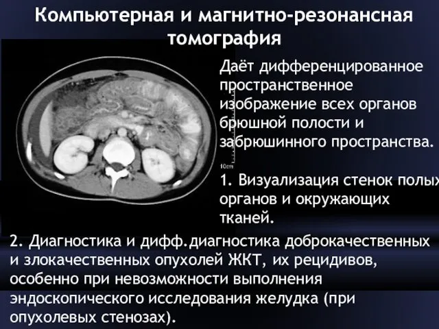 Компьютерная и магнитно-резонансная томография Даёт дифференцированное пространственное изображение всех органов брюшной