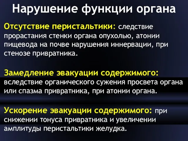 Нарушение функции органа Отсутствие перистальтики: следствие прорастания стенки органа опухолью, атонии