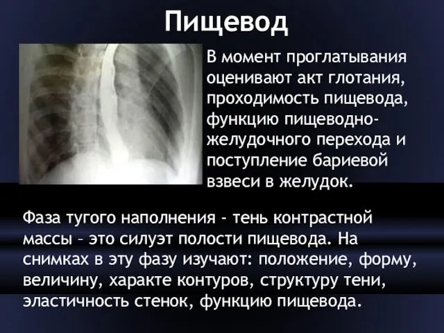 Пищевод В момент проглатывания оценивают акт глотания, проходимость пищевода, функцию пищеводно-желудочного